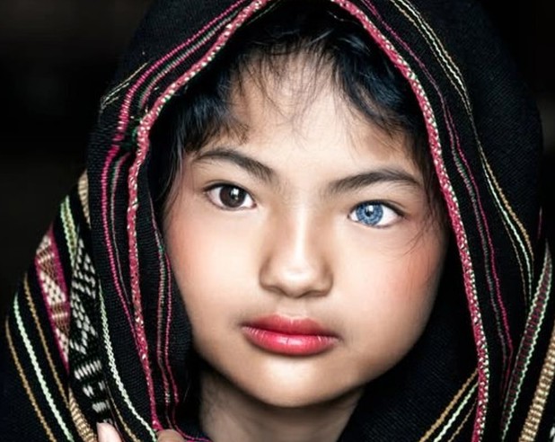 Vietnamese Girl with One Blue Eye and One Brown Eye Captivates the Internet
