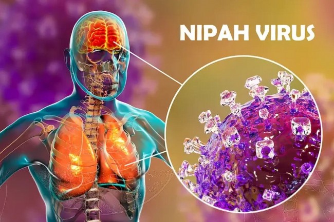 What is the Nipah Virus? Causes, Outbreaks, Transmission, Treatment Gaps, Vaccine Progress