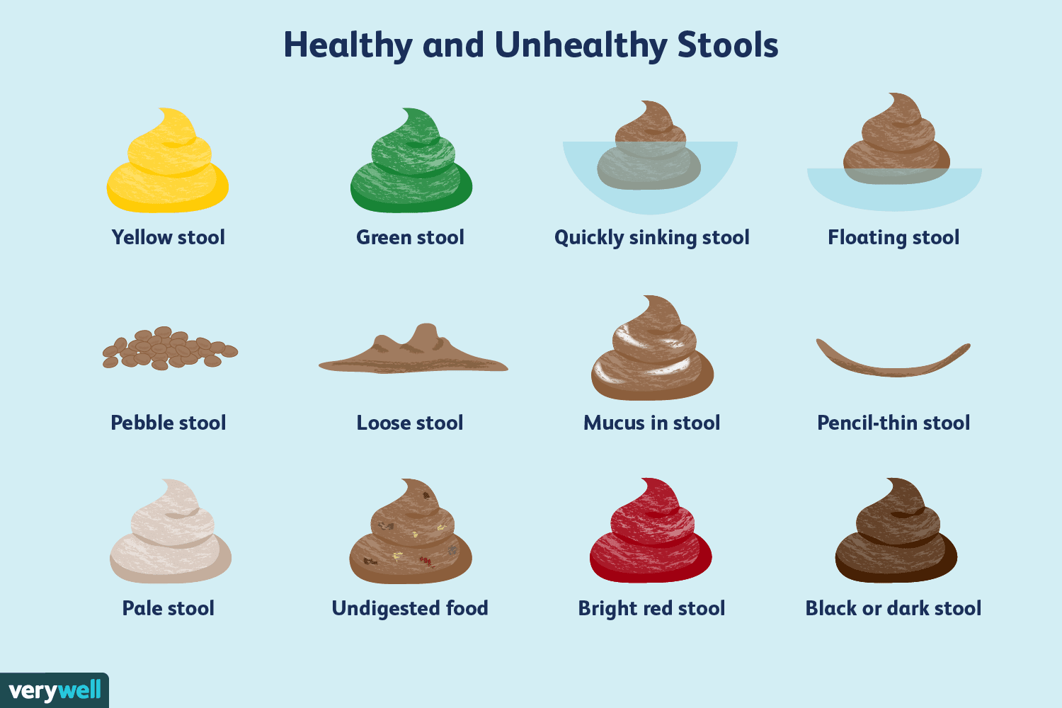 Green Poop in Kids: Unignorable Symptoms